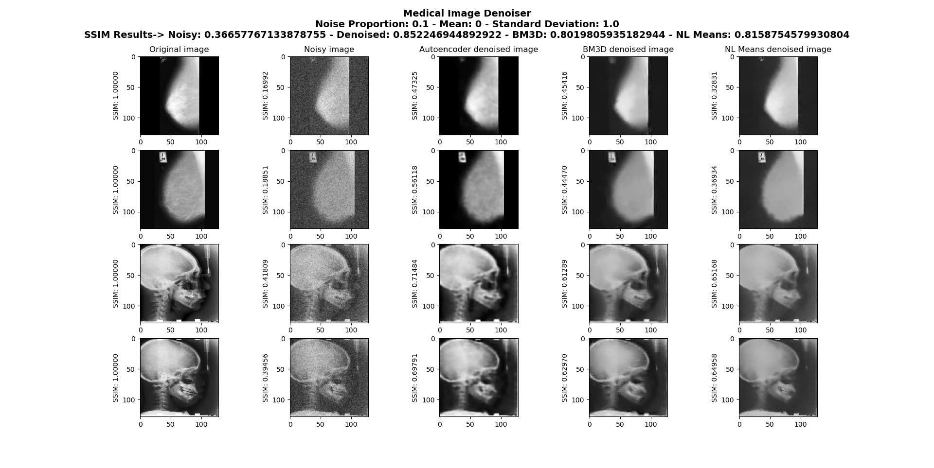 Medical image denoising using convolutional denoising autoencoders